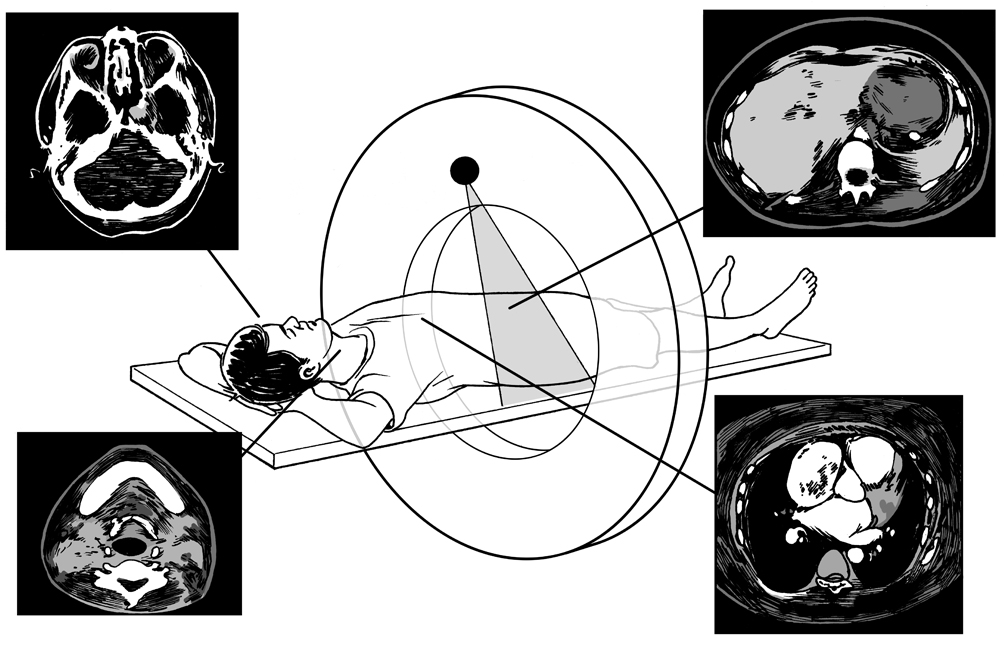 scan mri 2